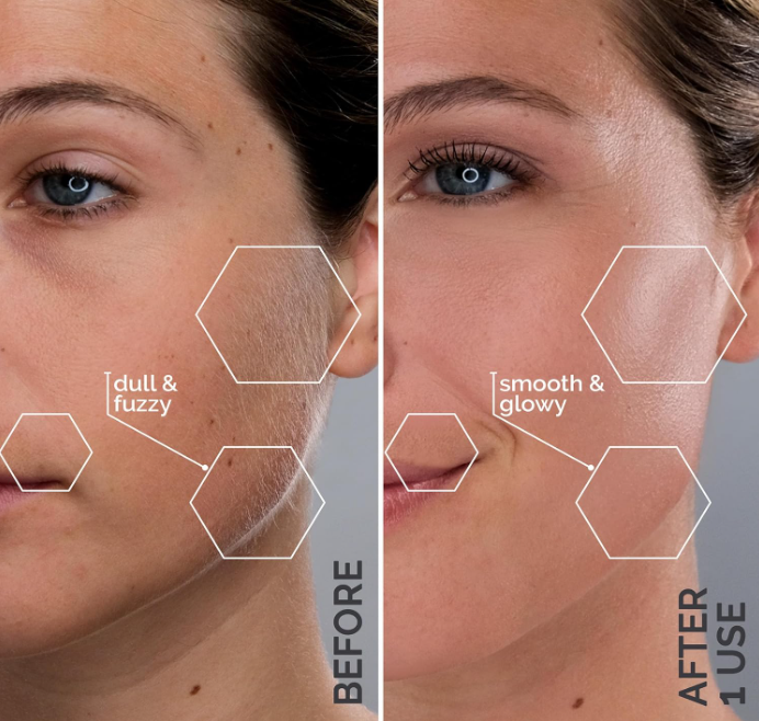 Sonicsmooth: Award-Winning Sonic Dermaplaning for Radiant Skin